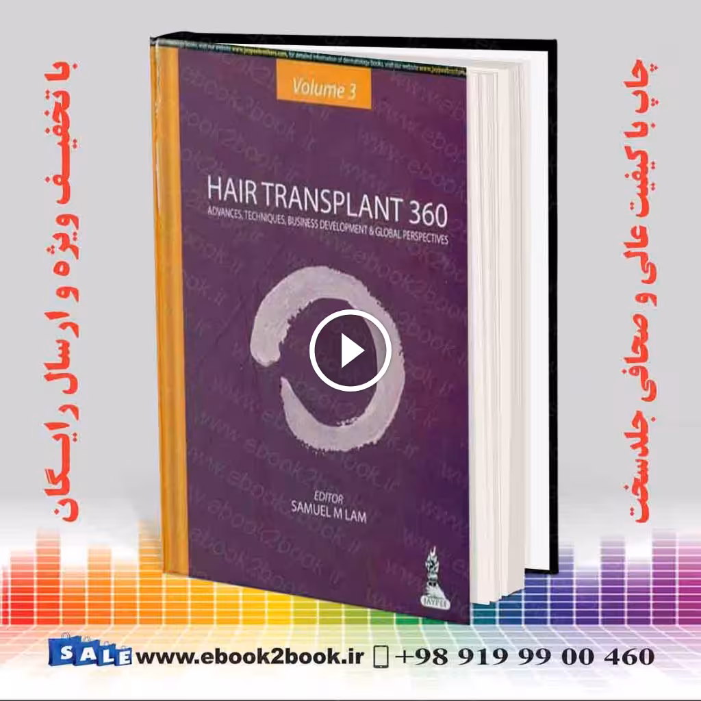 Hair Transplant 360