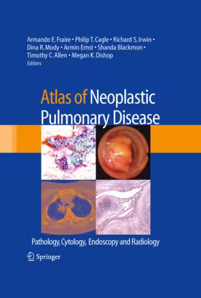 خرید و دانلود نسخه کامل کتاب Atlas of Neoplastic Pulmonary Disease: Pathology, Cytology, Endoscopy and Radiology