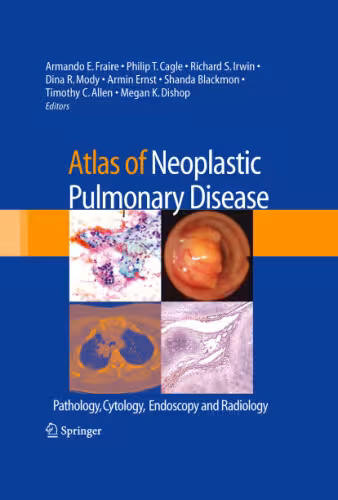 خرید و دانلود نسخه کامل کتاب Atlas of Neoplastic Pulmonary Disease: Pathology, Cytology, Endoscopy and Radiology