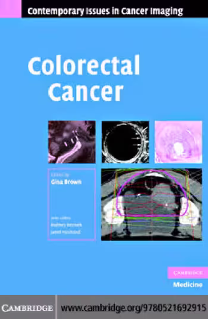 خرید و دانلود نسخه کامل کتاب Colorectal Cancer (Contemporary Issues in Cancer Imaging)