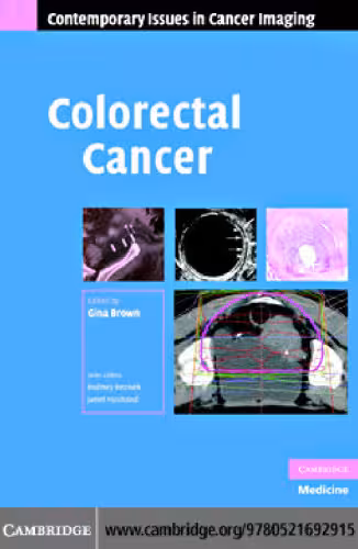 خرید و دانلود نسخه کامل کتاب Colorectal Cancer (Contemporary Issues in Cancer Imaging)