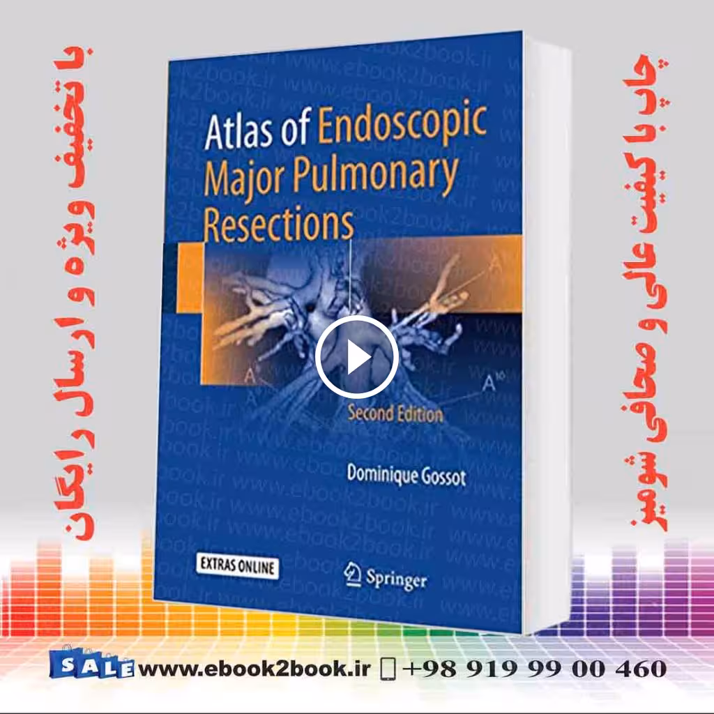 Atlas of Endoscopic Major Pulmonary Resections 2nd Edition