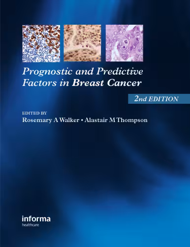 خرید و دانلود نسخه کامل کتاب Prognostic and Predictive Factors in Breast Cancer,