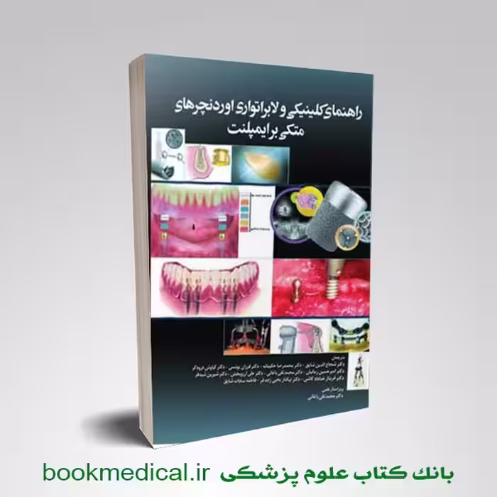 راهنمای کلینیکی و لابراتوآری اوردنچرهای متکی بر ایمپلنت