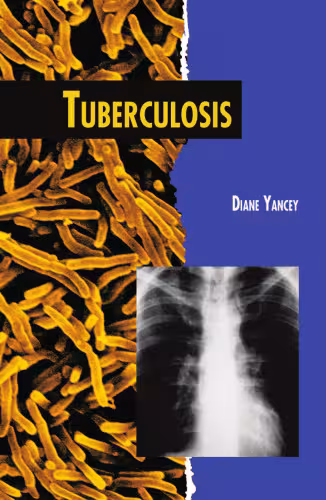 خرید و دانلود نسخه کامل کتاب Tuberculosis (Twenty-First Century Medical Library)