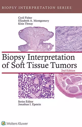 خرید و دانلود نسخه کامل کتاب Biopsy Interpretation of Soft Tissue Tumors