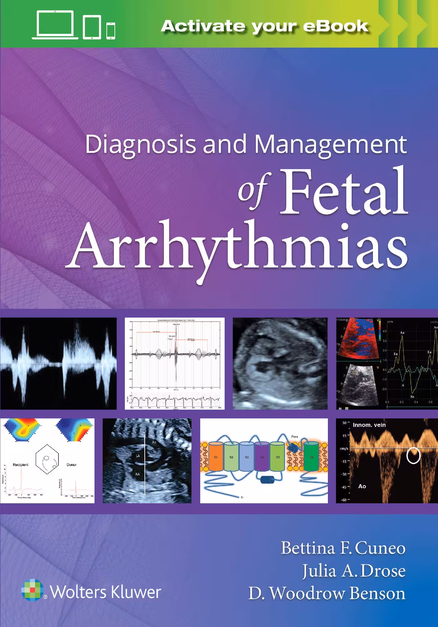 خرید و دانلود نسخه کامل کتاب Diagnosis and Management of Fetal Arrhythmias