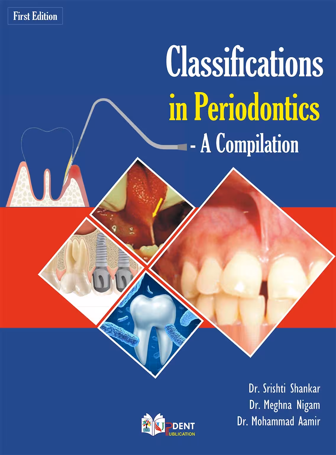 کتاب Classifications in Periodontics – A Compilation 2024