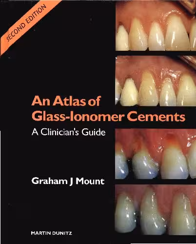 خرید و دانلود نسخه کامل کتاب An Atlas of Glass Ionomer Cements