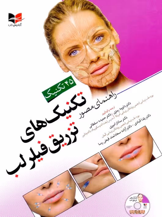 راهنمای مصور تکنیک‌ های تزریق فیلر لب رمزی آبادیس طب