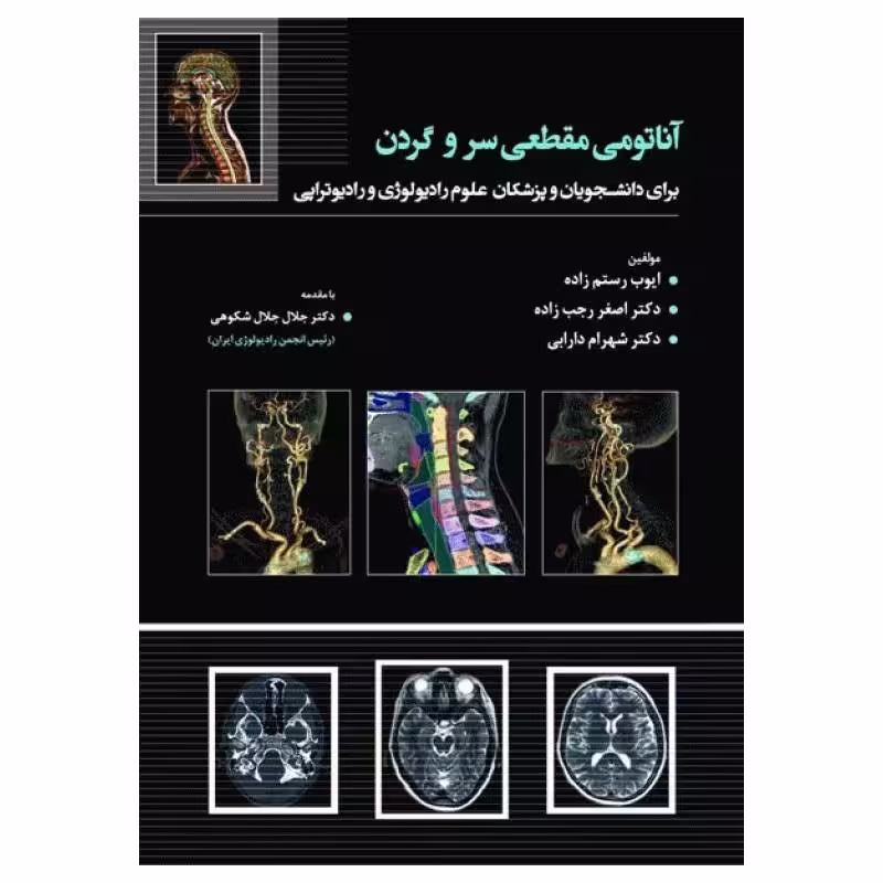 کتاب آناتومی مقطعی سر و گردن برای دانشجویان و پزشکان علوم رادیولوژی و رادیوتراپی