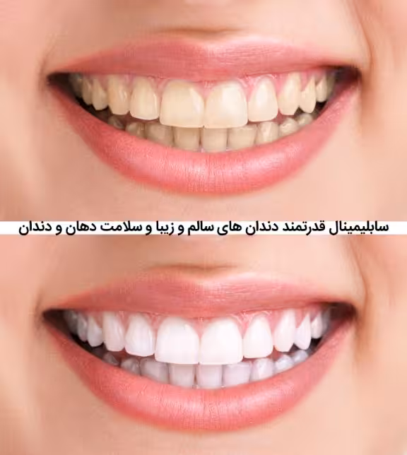 سابلیمینال فارسی دندان های سالم و زیبا و سلامت دهان و دندان