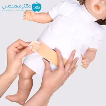 ناف بند اطفال طب و صنعت کد 85400