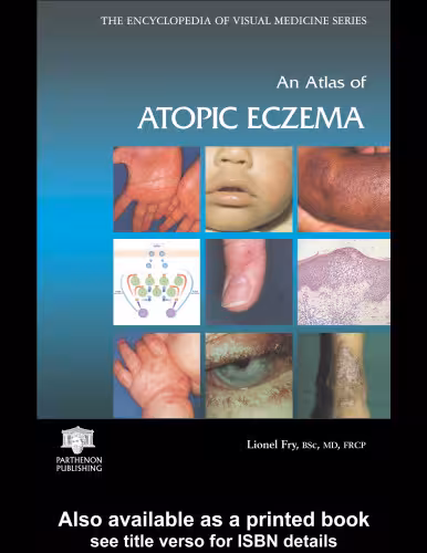خرید و دانلود نسخه کامل کتاب An Atlas of Atopic Eczema (Encyclopedia of Visual Medicine Series)
