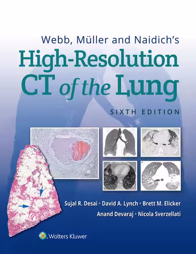 خرید و دانلود نسخه کامل کتاب Webb, Müller and Naidich's High-Resolution CT of the Lung