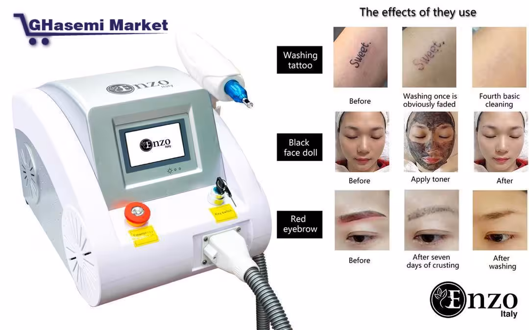 دستگاه لیزر کیوسوئیچ برند کندلا candela