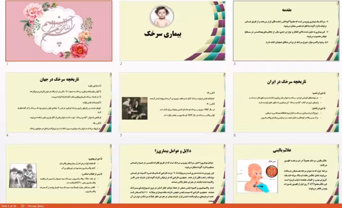 دانلود جذاب ترین پاورپوینت بیماری سرخک