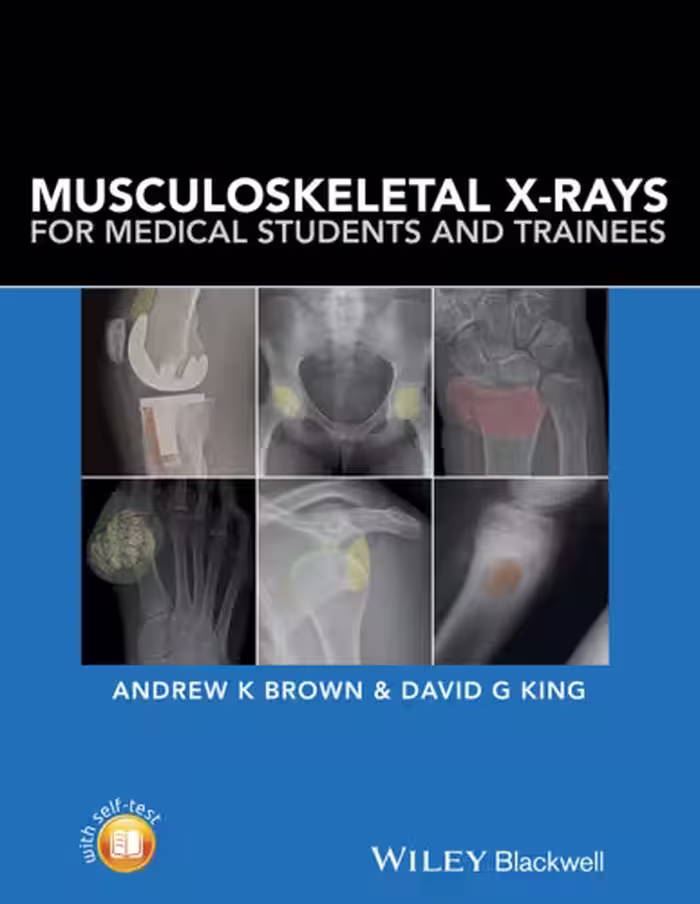 خرید و دانلود نسخه کامل کتاب Musculoskeletal X-Rays for Medical Students and Trainees