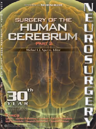 خرید و دانلود نسخه کامل کتاب Surgery of the Human Cerebrum