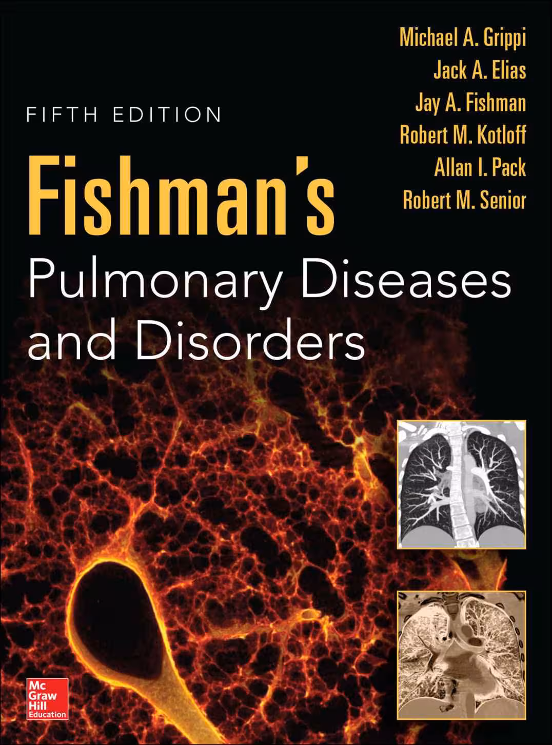 خرید و دانلود نسخه کامل کتاب Fishman’s Pulmonary Diseases and Disorders, Fifth Edition