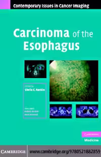 خرید و دانلود نسخه کامل کتاب Carcinoma of the Esophagus (Contemporary Issues in Cancer Imaging)