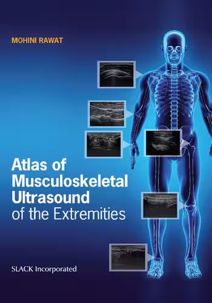 خرید و دانلود نسخه کامل کتاب Atlas of Musculoskeletal Ultrasound of the Extremities