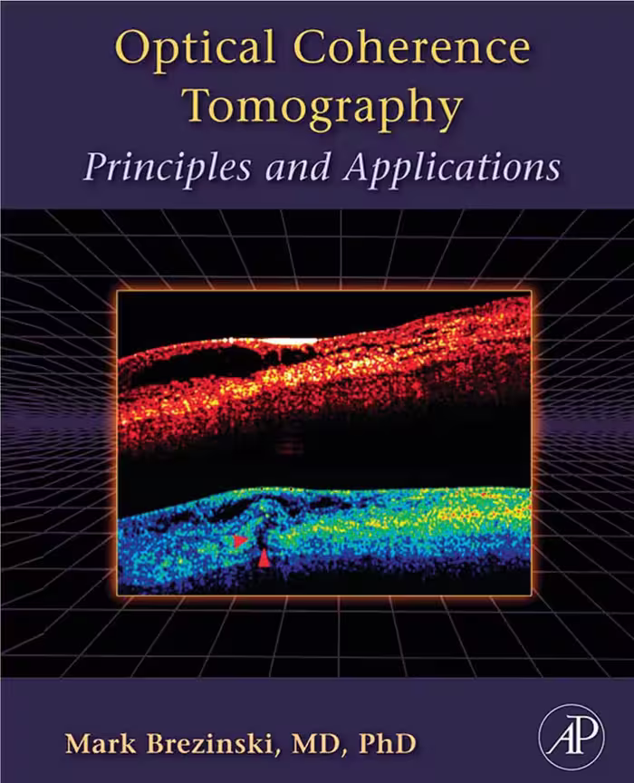 خرید و دانلود نسخه کامل کتاب Optical coherence tomography : principles and applications