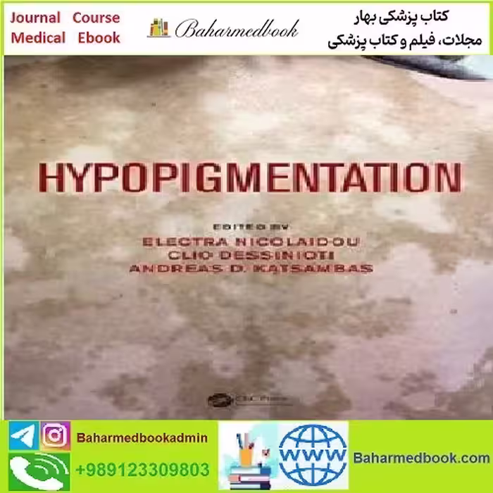 Hypopigmentation TRUE PDF price 1€ - کتاب پزشکی بهار