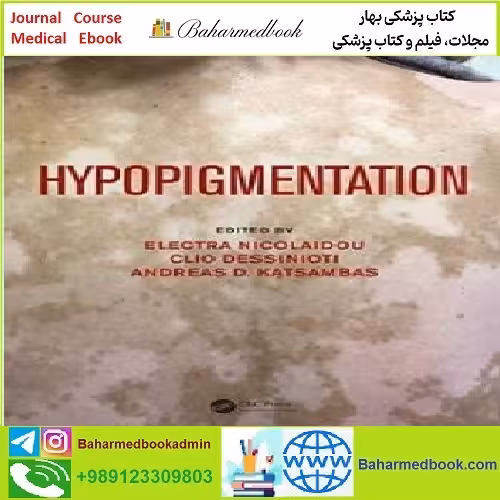Hypopigmentation TRUE PDF price 1€ - کتاب پزشکی بهار