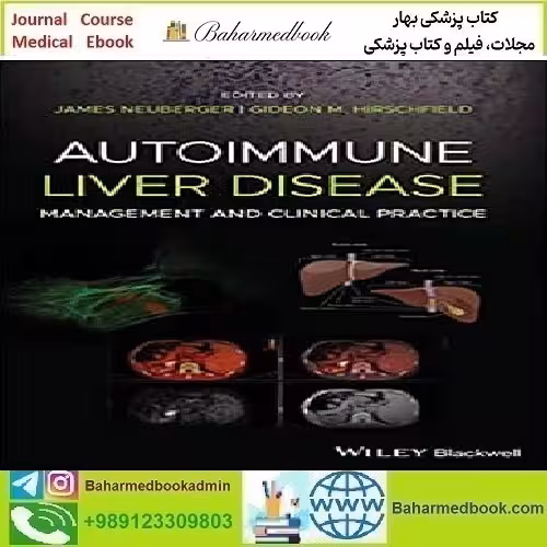 Autoimmune Liver Disease 2020 TRUE PDF price 1€ - کتاب پزشکی بهار