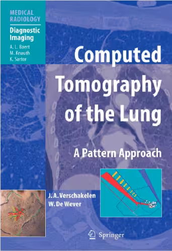 خرید و دانلود نسخه کامل کتاب Computed Tomography of the Lung A Pattern Approach