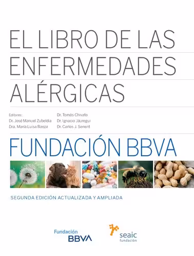 خرید و دانلود نسخه کامل کتاب El Libro de las Enfermedades Alérgicas