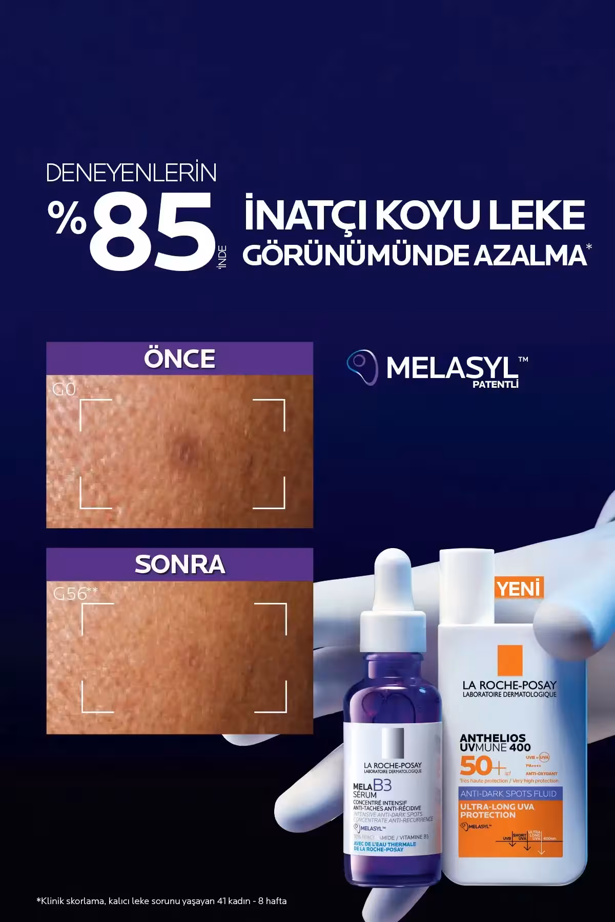 کرم ضد آفتاب آنتلئوس Uvmune 400 با SPF 50 و حجم 50 میلی لیتر، مایع ضد لک پوست صورت - 7146