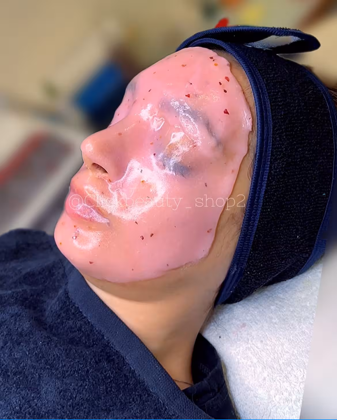 ماسک هیدروژلی آبرسان گیلاس