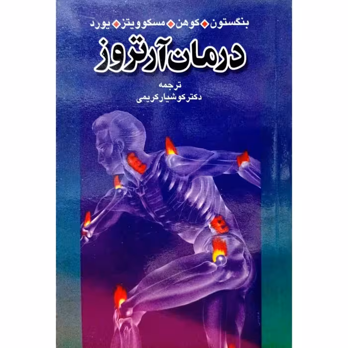 درمان آرتروز