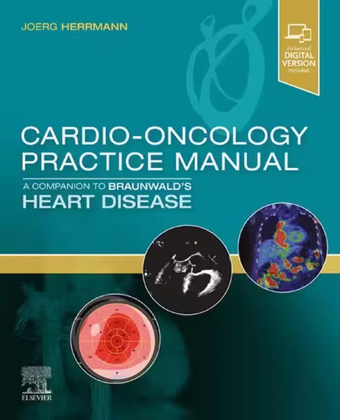 خرید و دانلود نسخه کامل کتاب Cardio-Oncology Practice Manual: A Companion to Braunwald's Heart Disease