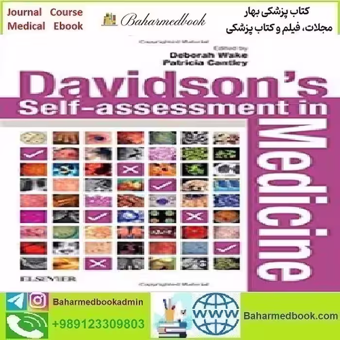 Davidson's Self assessment in Medicine 2018 TRUE PDF price 1€ - کتاب پزشکی بهار