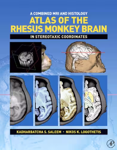 خرید و دانلود نسخه کامل کتاب A Combined MRI and Histology Atlas of the Rhesus Monkey Brain in Stereotaxic Coordinates