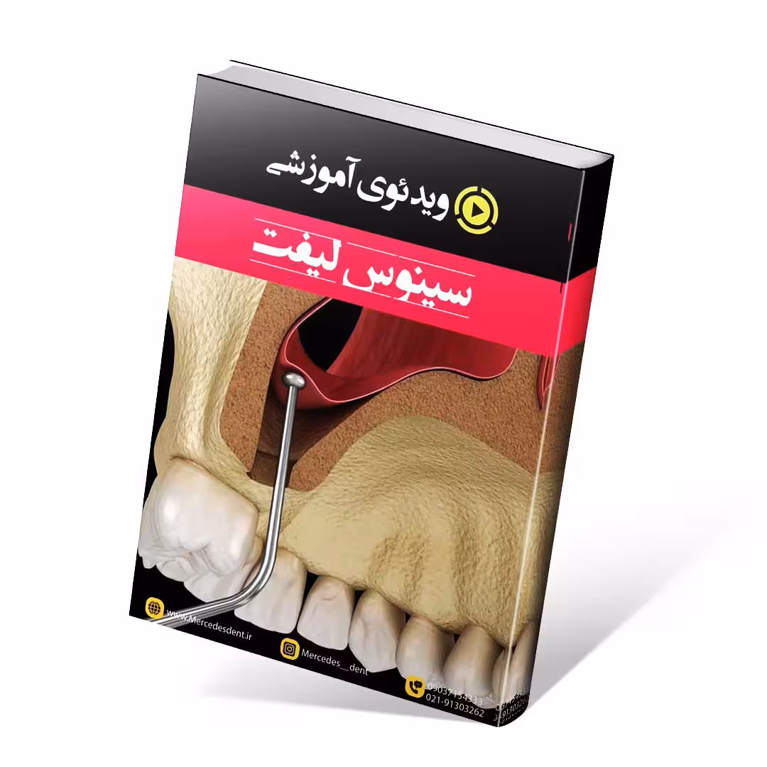 ویدئوی آموزشی سینوس لیفت (انگلیسی)