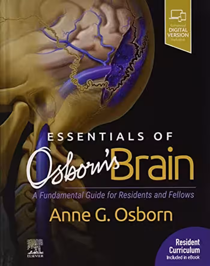 خرید و دانلود نسخه کامل کتاب Essentials of Osborn&#039;s Brain: A Fundamental Guide for Residents and Fellows, 1e (2020)