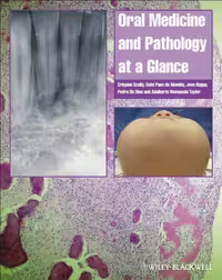 خرید و دانلود نسخه کامل کتاب Oral Medicine and Pathology at a Glance