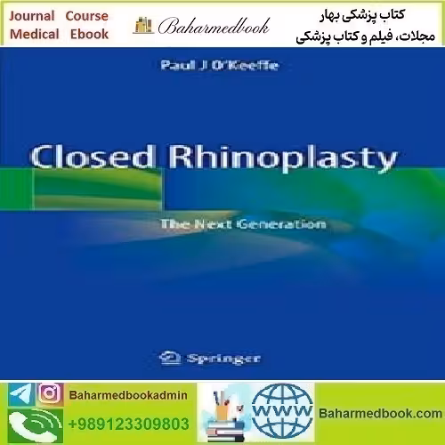 Closed Rhinoplasty The Next Generation 2019 TRUE PDF price 1€ - کتاب پزشکی بهار