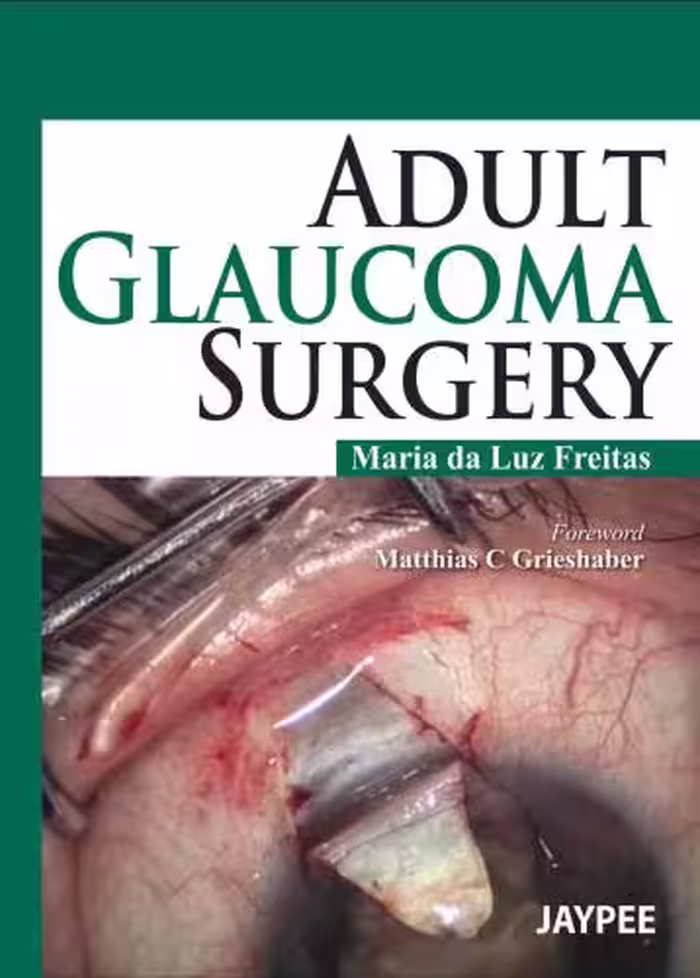 خرید و دانلود نسخه کامل کتاب Adult Glaucoma Surgery