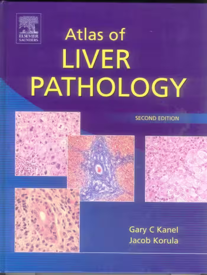 خرید و دانلود نسخه کامل کتاب Atlas of Liver Pathology, Second Edition (ATLAS OF SURGICAL PATHOLOGY)