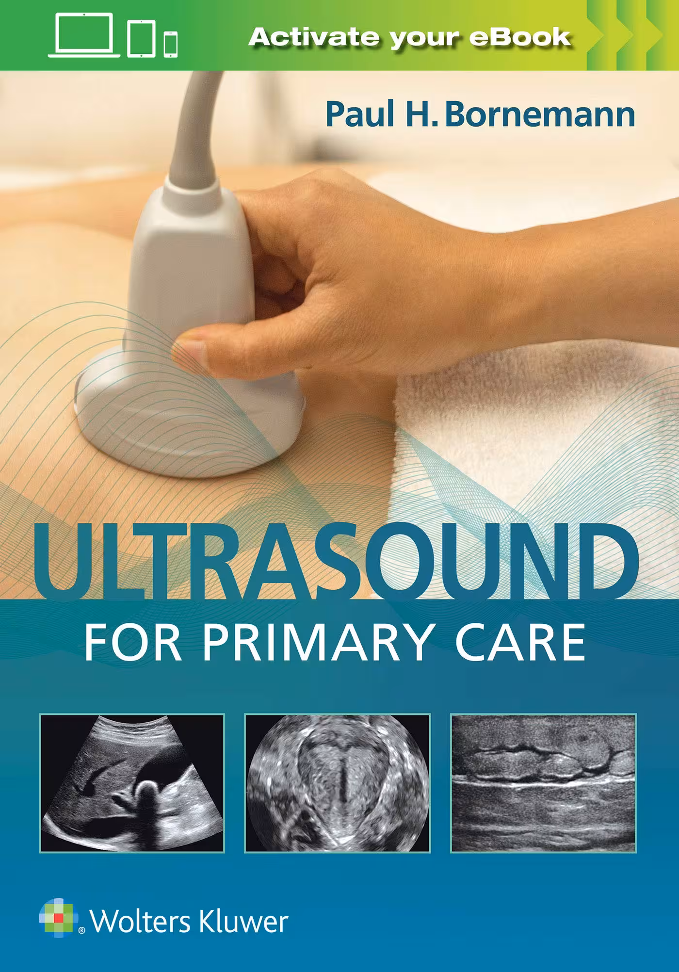 خرید و دانلود نسخه کامل کتاب Ultrasound for Primary Care