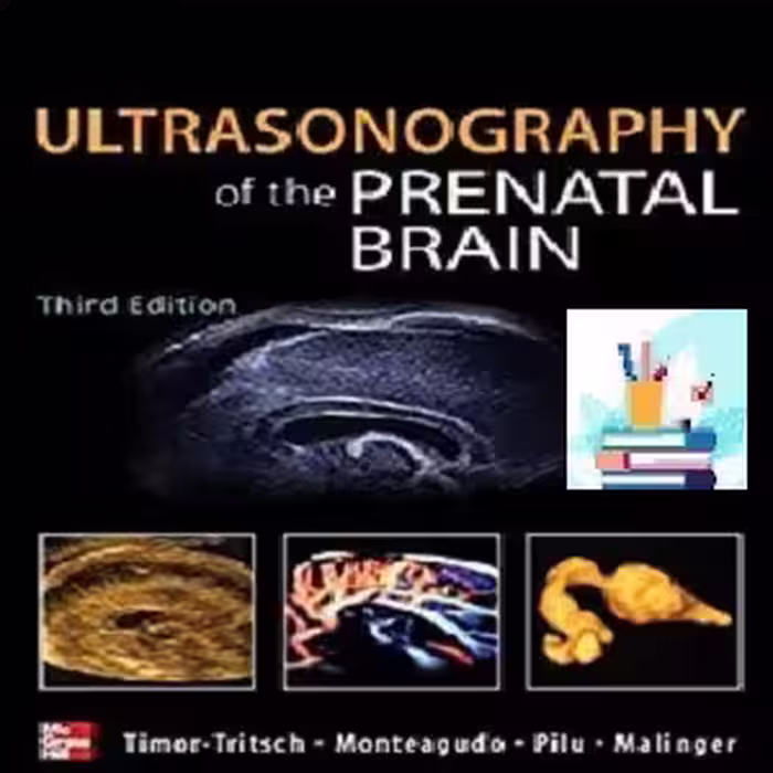 Ultrasonography of the Prenatal Brain TRUE PDF price 1€