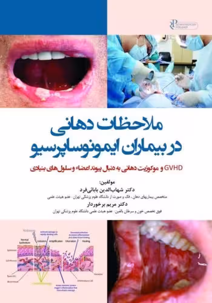 ملاحظات دهانی در بیماران ایمونوساپرسیو