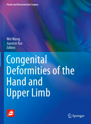 خرید و دانلود نسخه کامل کتاب Congenital Deformities of the Hand and Upper Limb