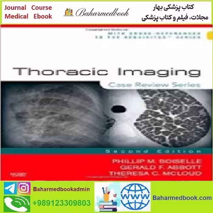 Thoracic Imaging TRUE PDF price 1€ - کتاب پزشکی بهار