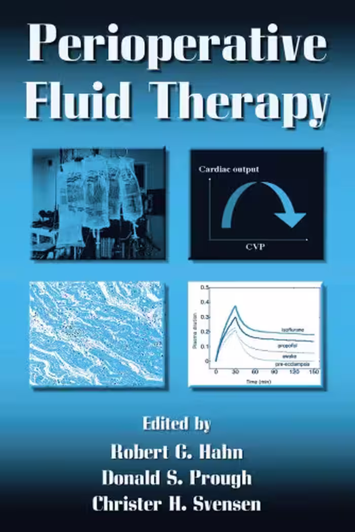 خرید و دانلود نسخه کامل کتاب Perioperative Fluid Therapy